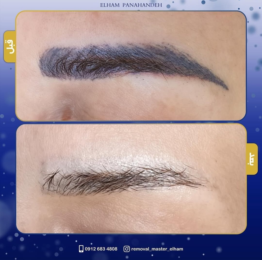 مدل رایگان ریموو ابرو و خط چشم