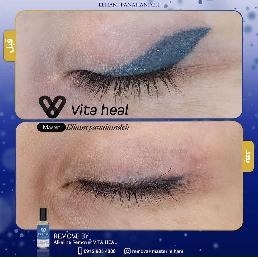 مدل رایگان ریموو ابرو و خط چشم