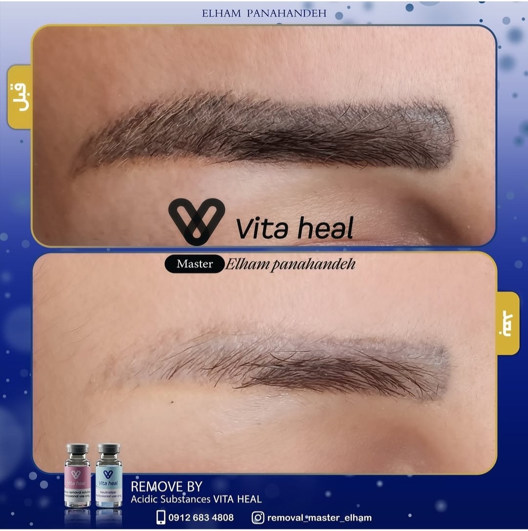 مدل رایگان ریموو ابرو و خط چشم