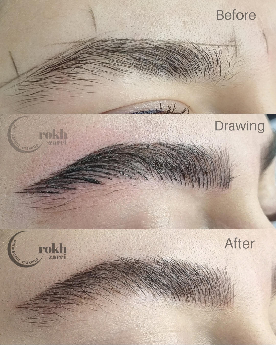 مدل میکروبلیدینگ(نچرال بروز)