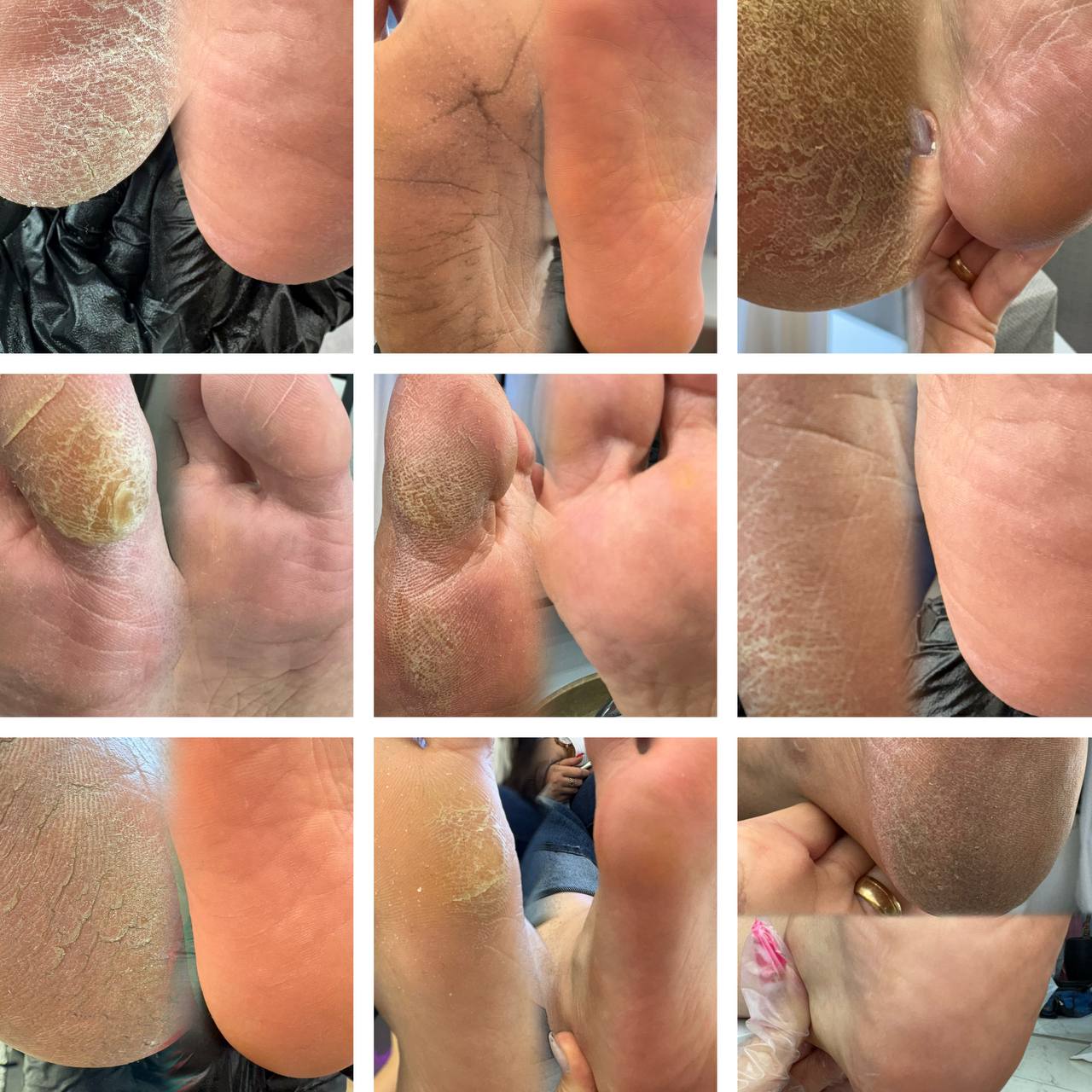 ورکشاپ پدیکور درمانی روسی