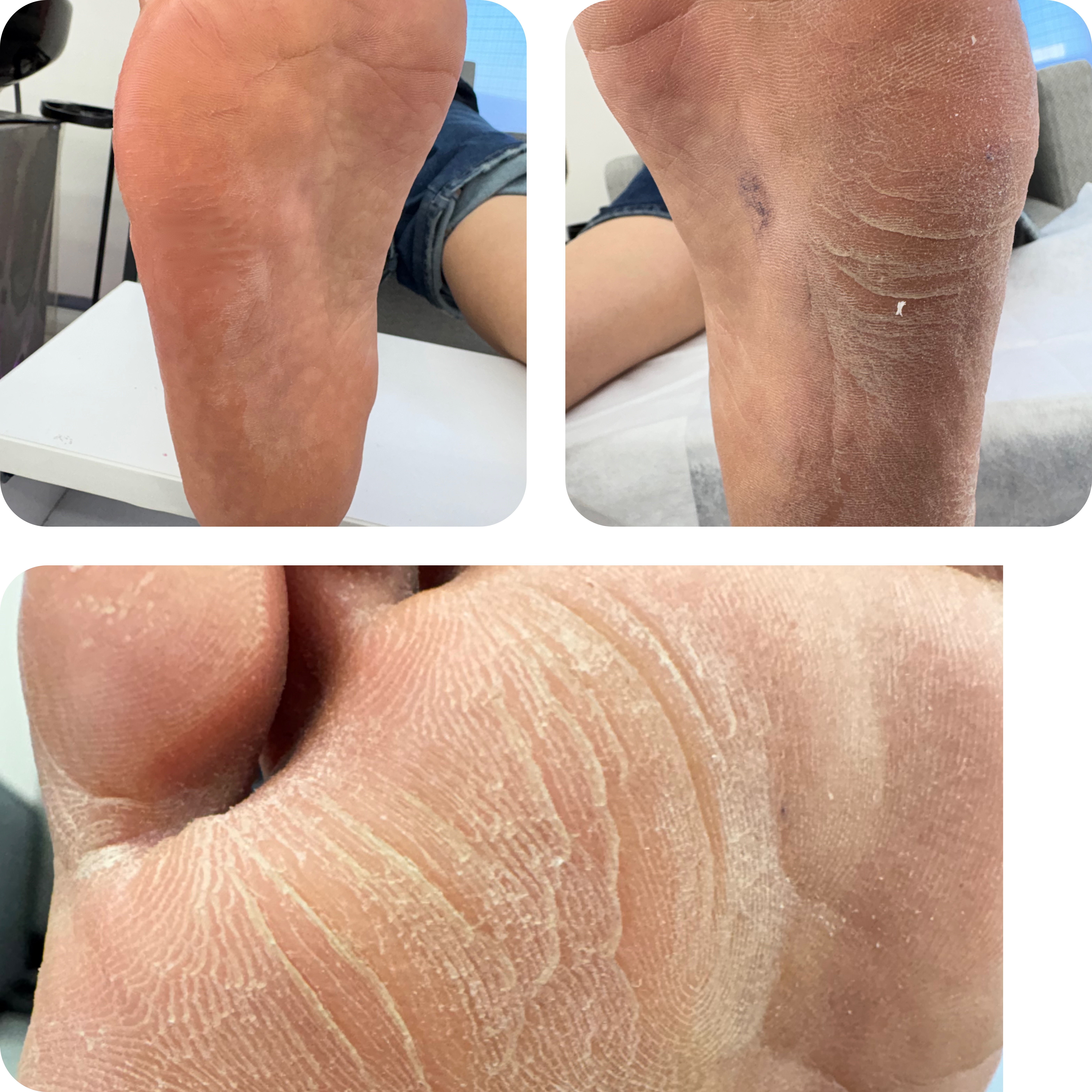 ورکشاپ پدیکور درمانی روسی